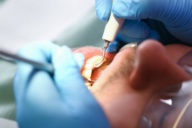 Best Pediatric Emergency Dentist in Washgton, IN