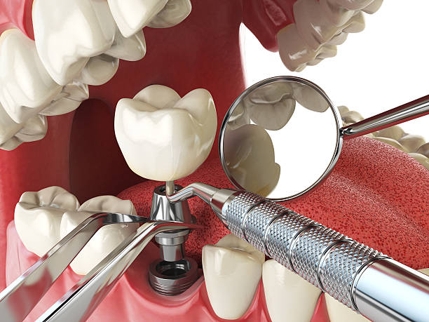 Best After-Hours Emergency Dentist in Washgton, IN